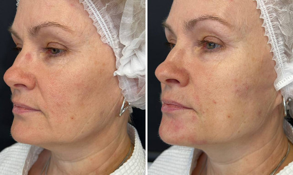 Бьюти квартирник