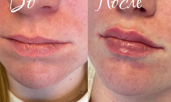 Бьюти квартирник