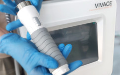 Vivace, RF-лифтинг