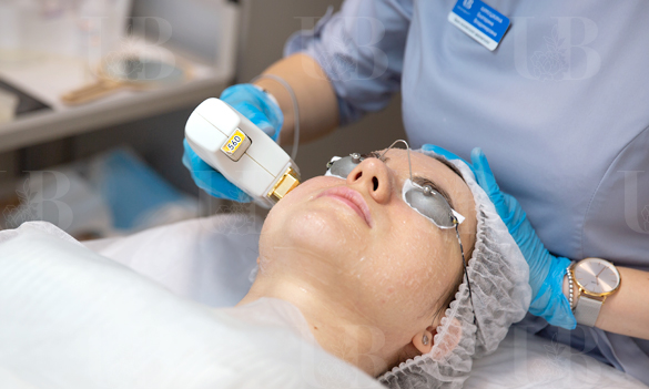 Фотоомоложение BBL HERO