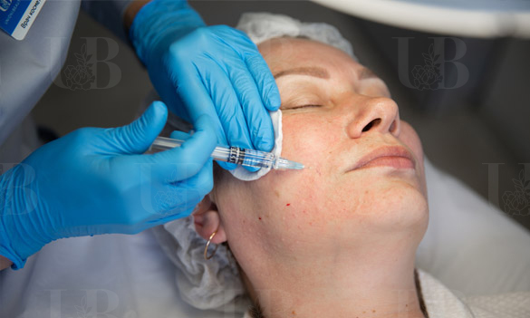 Биоревитализация