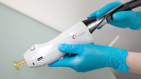 Candela Gentle Lase Pro Лазерная эпиляция