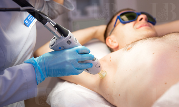 Candela Gentle Lase Pro Лазерная эпиляция