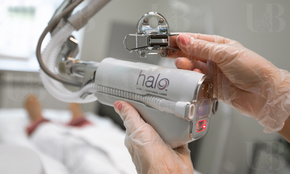 Лазерная шлифовка HALO