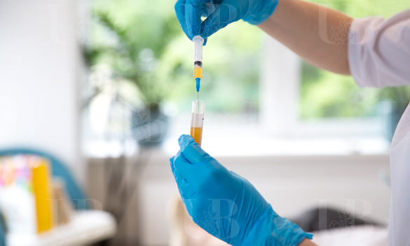 PRP-терапия волосистой части головы