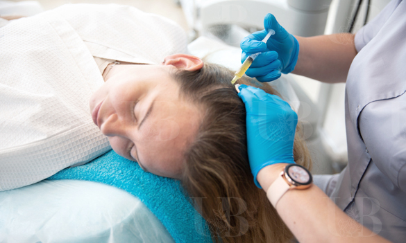 PRP-терапия волосистой части головы