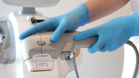 Ультразвуковой лифтинг (Ultraformer III)