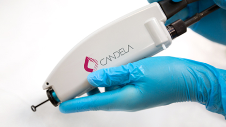 Gentle Yag  Лечение сосудистых дефектов