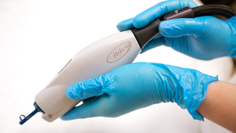 VBEAM Лечение сосудистых дефектов